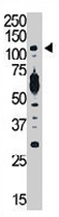 PAB3214 - PIK3CD
