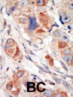 PAB3214 - PIK3CD