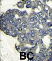 PAB3215 - PIK3CD