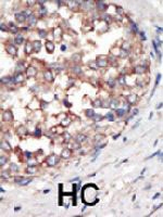 PAB3218 - PIK3CG