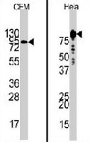 PAB3220 - PIK3R1 / GRB1