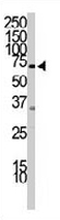 PAB3222 - PIK3R2
