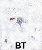 PAB3225 - PIK3R2
