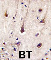 PAB3226 - PIK3R2