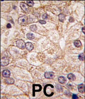 PAB3229 - PI4K2B