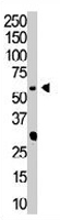 PAB3232 - PIP5K1A