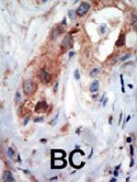 PAB3233 - PIP5K1B