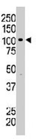PAB3245 - BRD2
