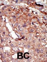 PAB3245 - BRD2
