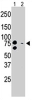 PAB3246 - BRD3
