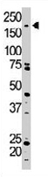 PAB3249 - TRPM7