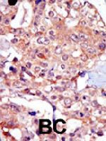 PAB3249 - TRPM7
