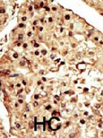 PAB3250 - TRPM7