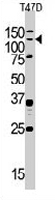 PAB3262 - BUB1A