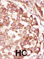 PAB3263 - BUB1B