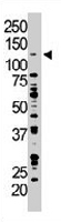 PAB3265 - DAG kinase zeta