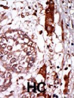PAB3270 - GNB2L1 / HLC7