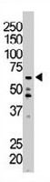 PAB3272 - EIF2AK1 / HRI