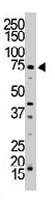 PAB3274 - NUAK1 / ARK5