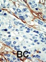 PAB3274 - NUAK1 / ARK5