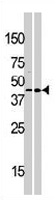 PAB3278 - MOS