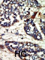 PAB3282 - NEK1