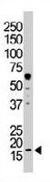 PAB3290 - NDP kinase A
