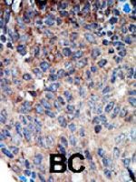 PAB3290 - NDP kinase A