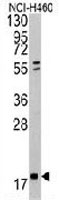 PAB3291 - NME2