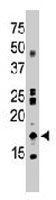 PAB3291 - NME2