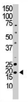 PAB3293 - NME6