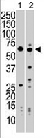 PAB3296 - Nrbp1