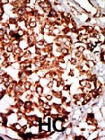 PAB3296 - Nrbp1