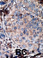 PAB3298 - ARHGAP26 / OPHN1L