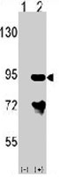 PAB3298 - ARHGAP26 / OPHN1L