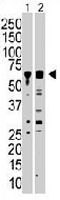PAB3299 - PACSIN1