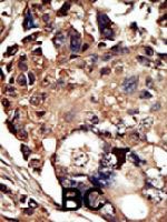 PAB3299 - PACSIN1
