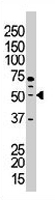 PAB3300 - PACSIN1