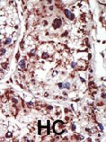 PAB3300 - PACSIN1