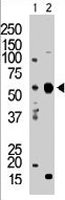 PAB3301 - PACSIN2