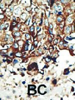 PAB3301 - PACSIN2