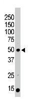 PAB3303 - PACSIN3