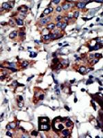 PAB3303 - PACSIN3