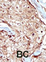 PAB3306 - PAPSS2