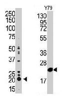 PAB3307 - PEBP1 / RKIP
