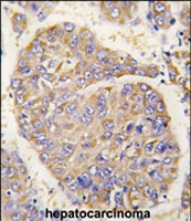 PAB3307 - PEBP1 / RKIP