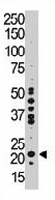 PAB3308 - PEBP1 / RKIP