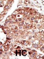 PAB3308 - PEBP1 / RKIP