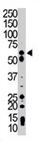 PAB3309 - PCK1 / PEPCK1