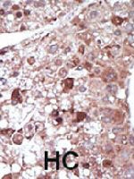 PAB3309 - PCK1 / PEPCK1